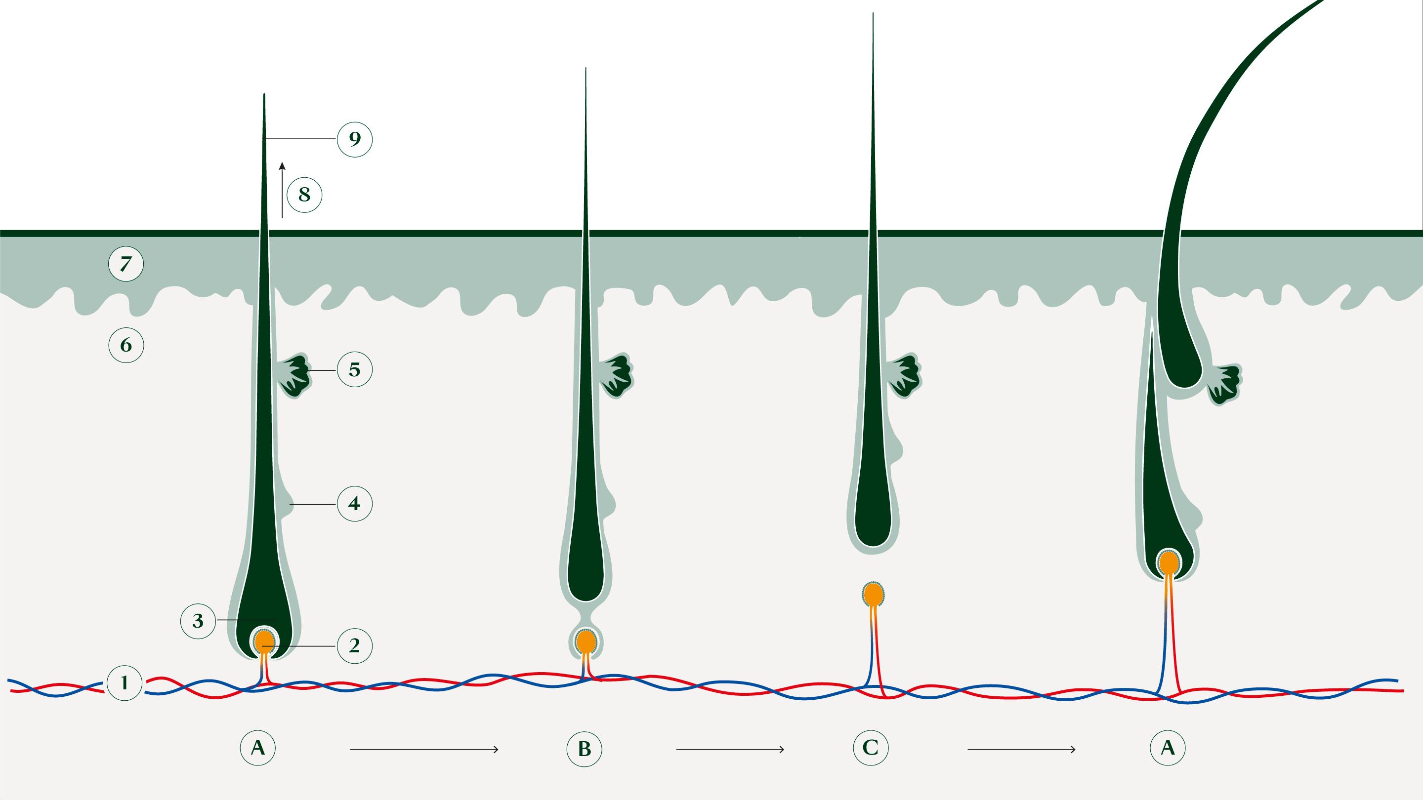 L’alopécie androgénique, première chute de cheveux